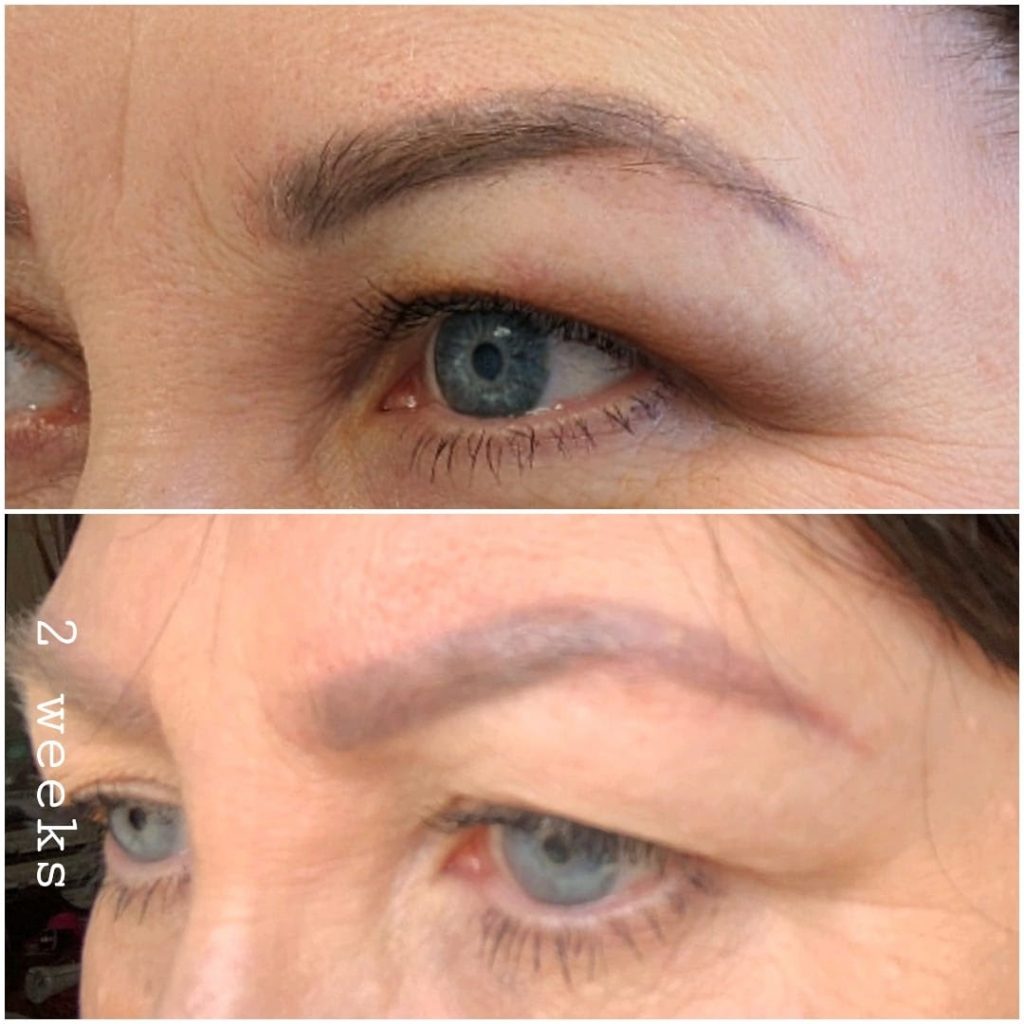 Permanent Makeup Correction and Removal