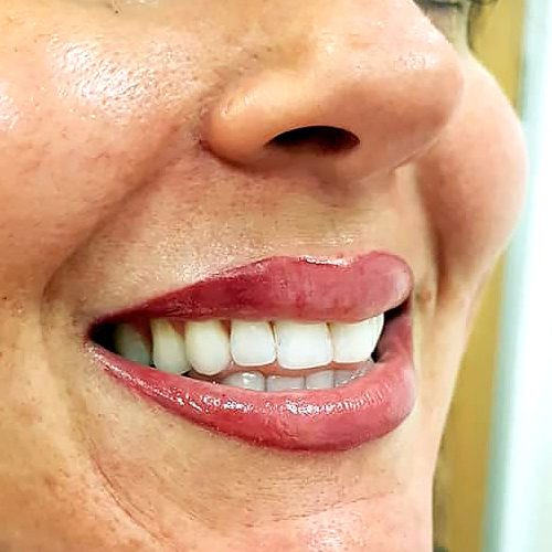 Permanent makeup Lip contour Luton by Tracy Fensome